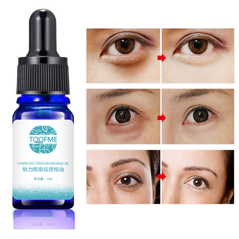 Eye Serum Treatment Remove Fine Lines Dark Circles Eye Bags Eye Contour