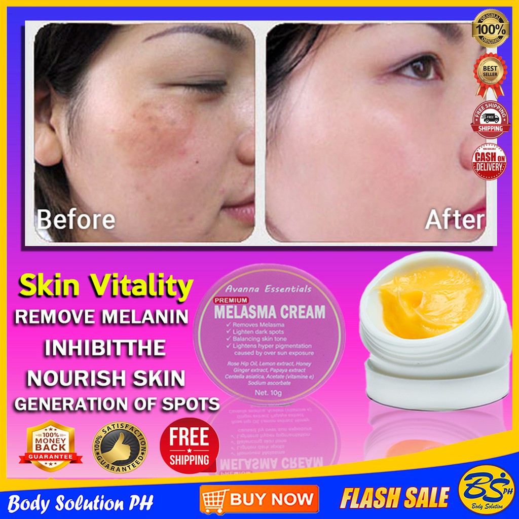 New Original Melasma Pekas Sun and Dark Spots Remover Cream 10g (1 Jar With 10g) Shopee