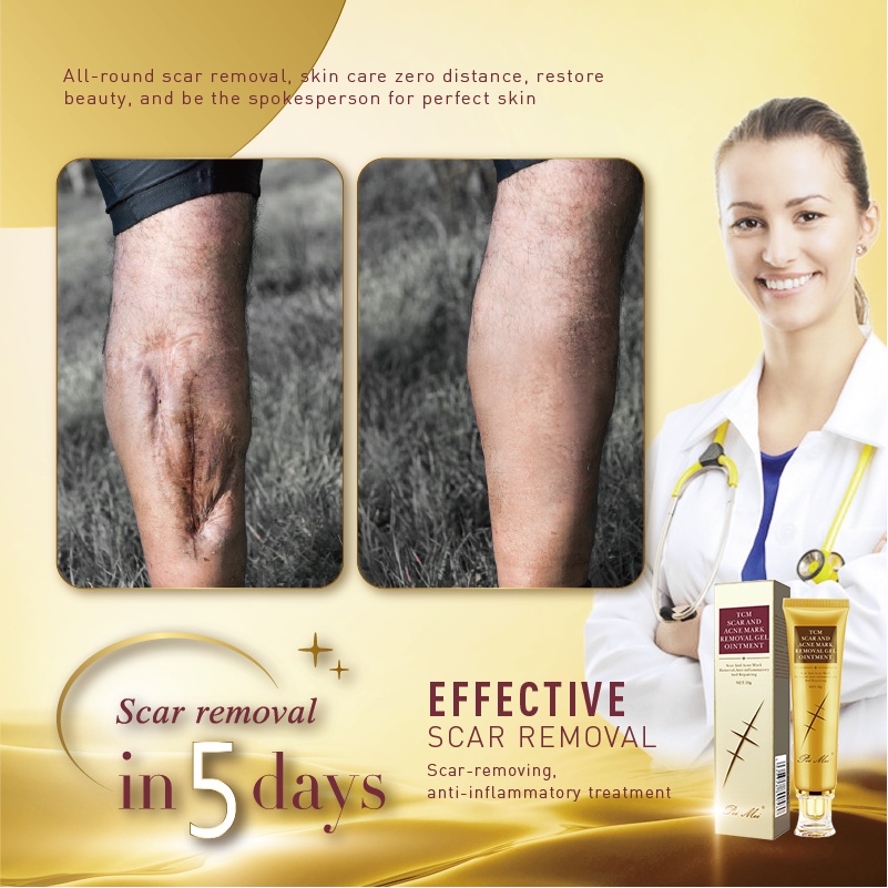 Scar Remover Gel Cream Scar peklat old acne scar Remover Skin Care Acne Treatment Whitening