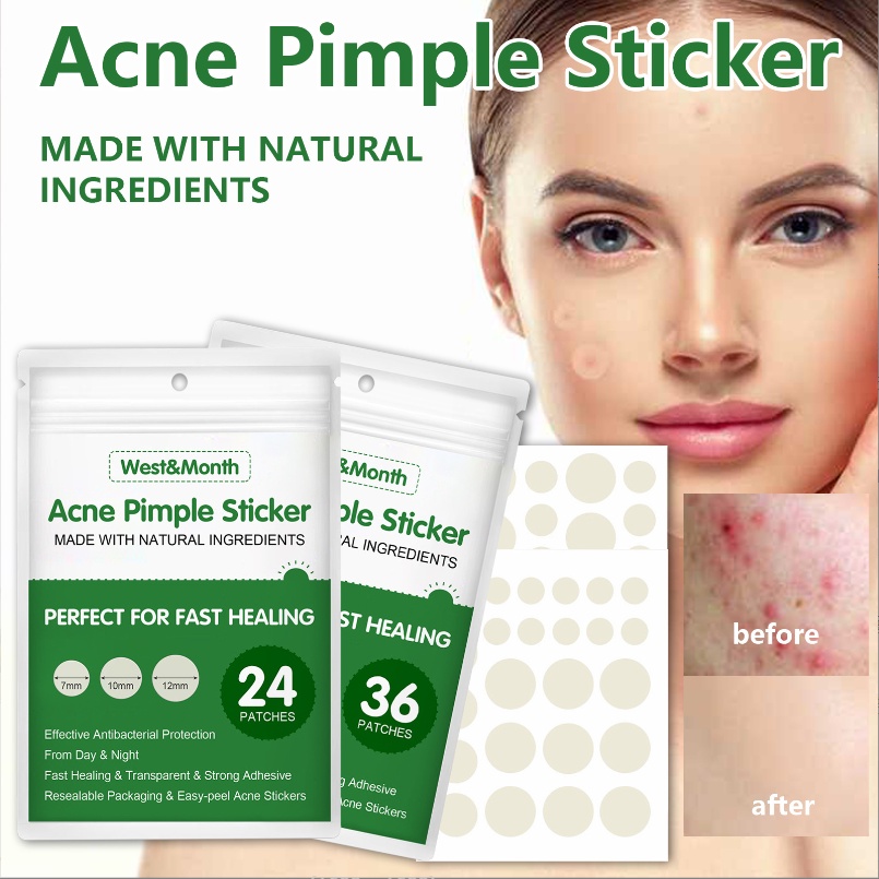 Acne Pimple Sticker Invisible Concealer Liquidabsorbing Acne Patch