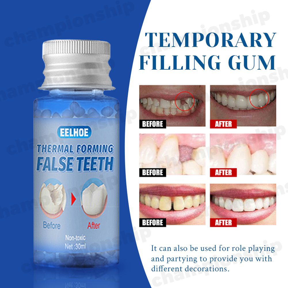 Temporary Tooth Repair Kit Teeth And Gaps FalseTeeth Solid Glue Denture