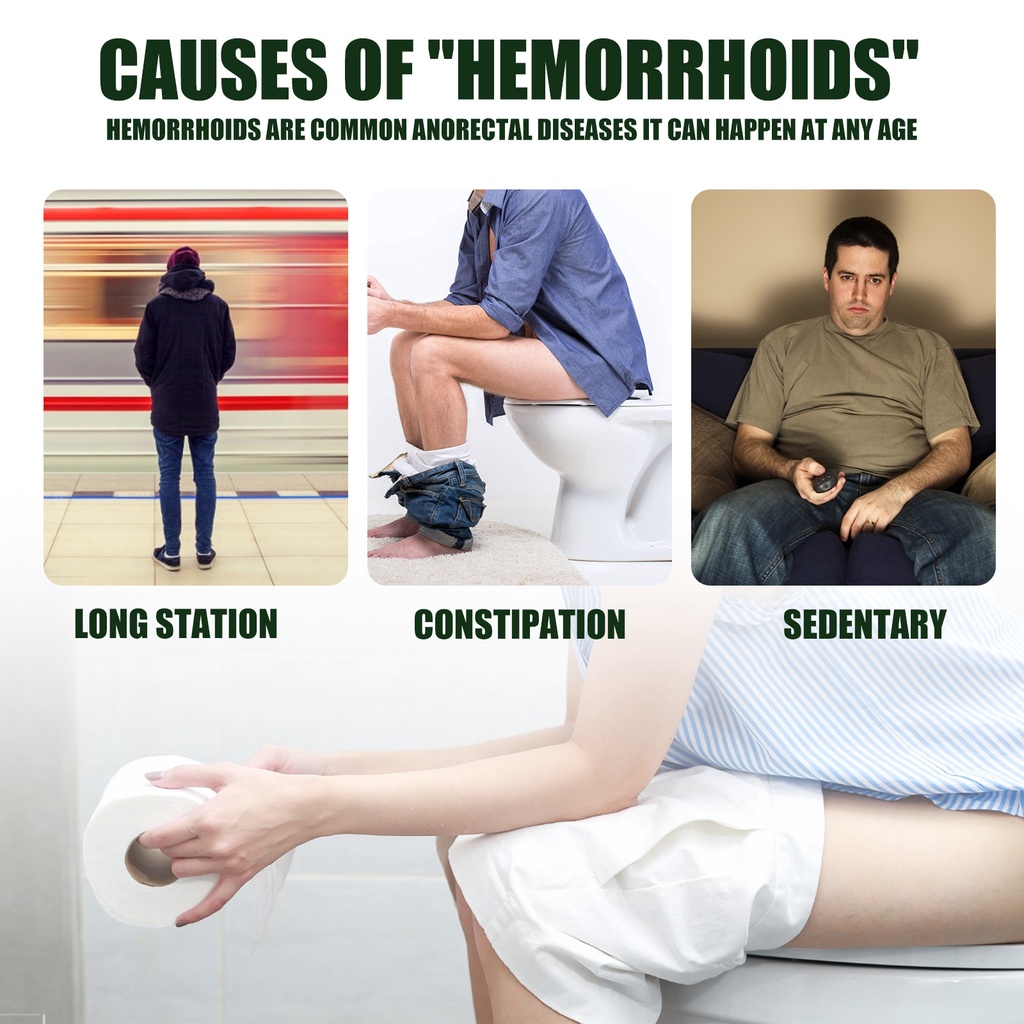 EELHOE Natural Herbal Hemorrhoids Spray Treatment AntiItchy