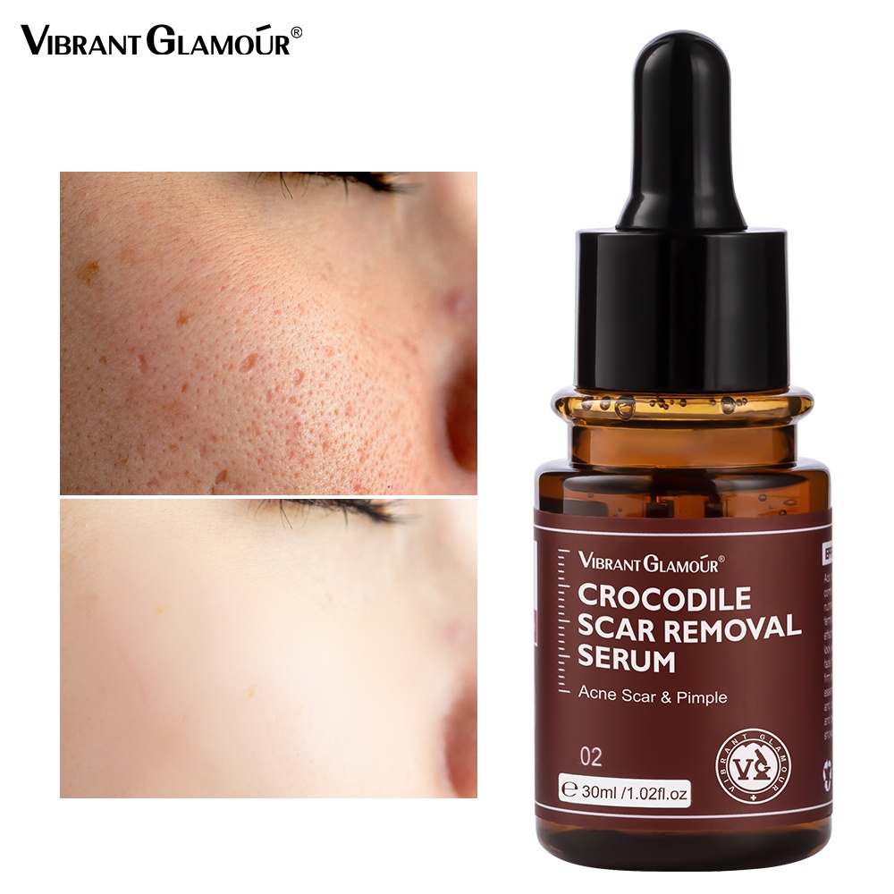 VIBRANT Glamor Crocodile Scars Repair Serum Acne Treatment Stretch