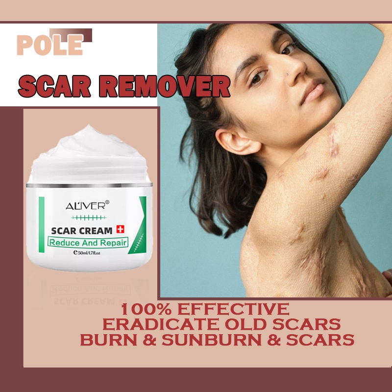 Aliver Deep Scar Remover Cream Acne Treatment Pimple Scar Removal for