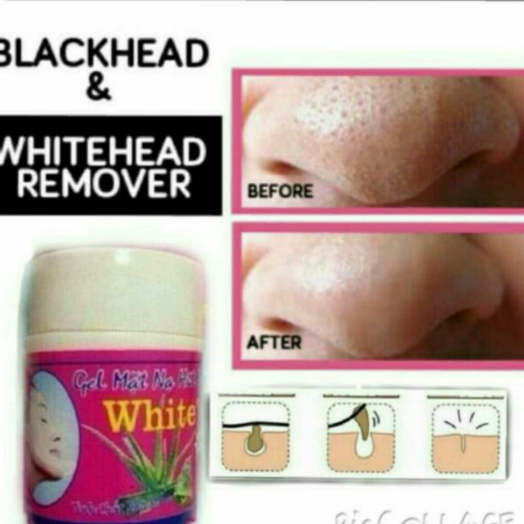 Vietnam white mask (whitehead & blackhead remover) gel hut mun Shopee