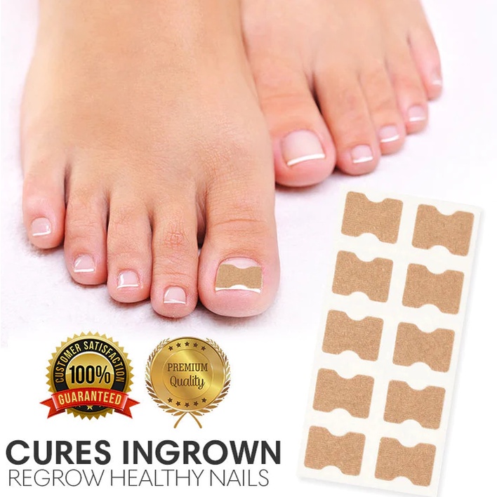 Ingrown Toenails Stickers Gluefree Toenail Patch Painless Pedicure