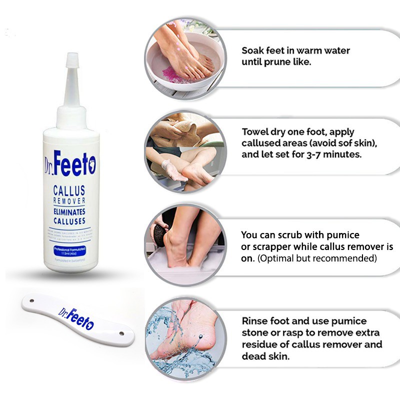 Dr Feeto Callus Remover Solution (118 ml / 1000 ml) Shopee Singapore