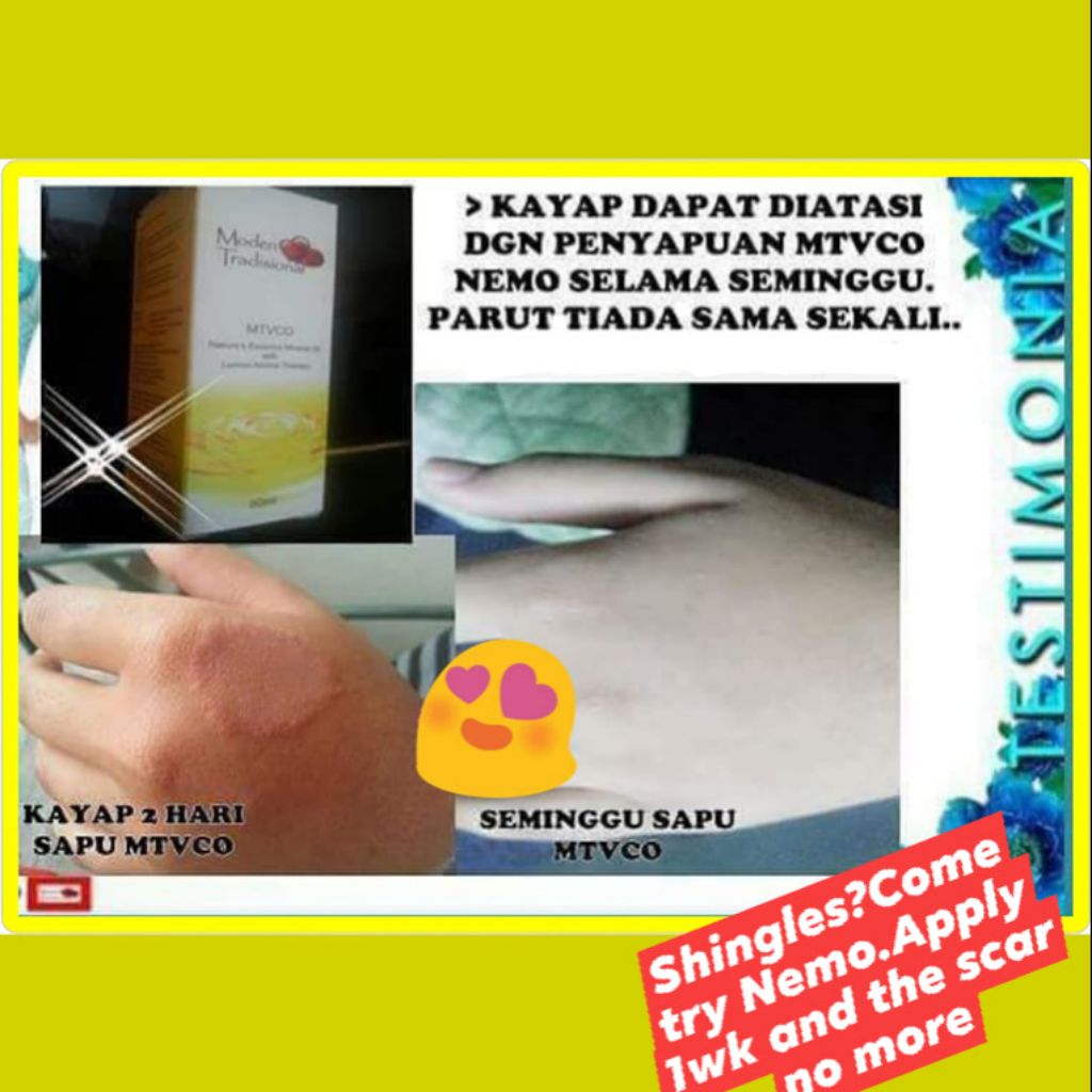 SKIN PROBLEM SET ECZEMA/PSORIASIS/SHINGLE/RINGWORM/SENSITIVE SKIN