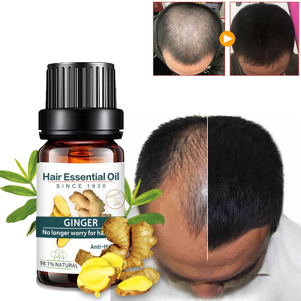 Natural Ginger Hair Growth Essence liquid Fast Hair Growth Natural Hair