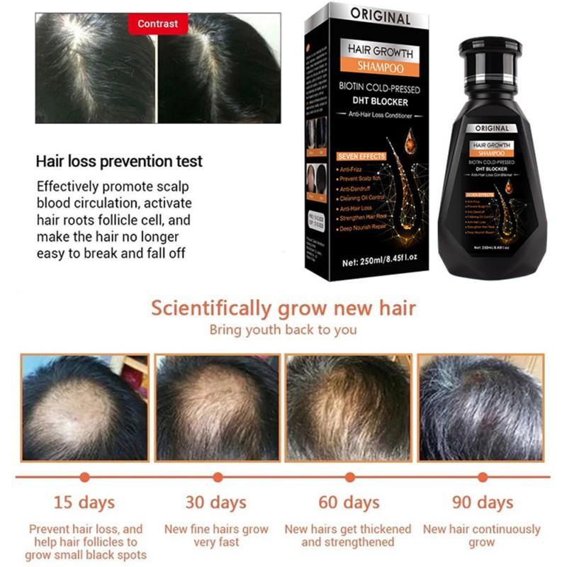 PEIMEI Hair Growth Essence Hair Shampoo AntiHair Loss Preventing Hair