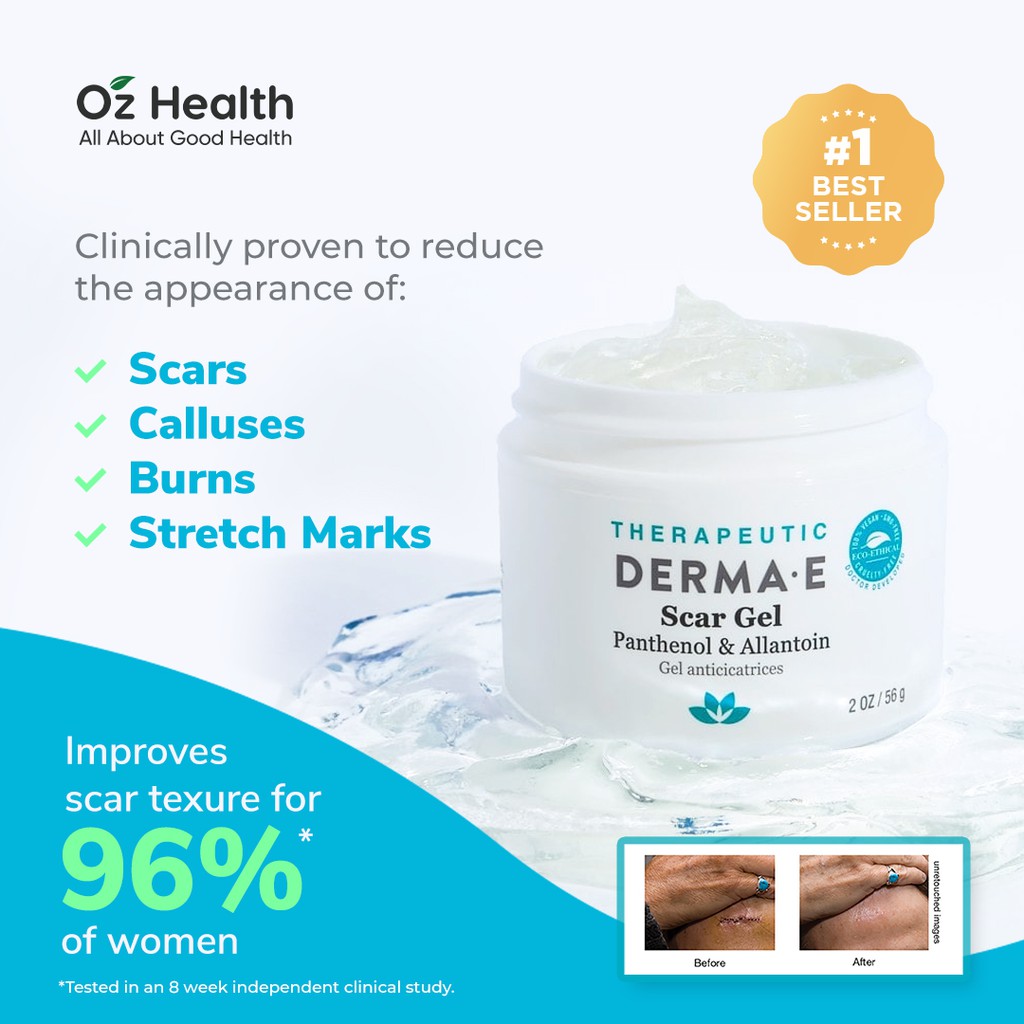 Derma E Scar Gel 56g Shopee Singapore