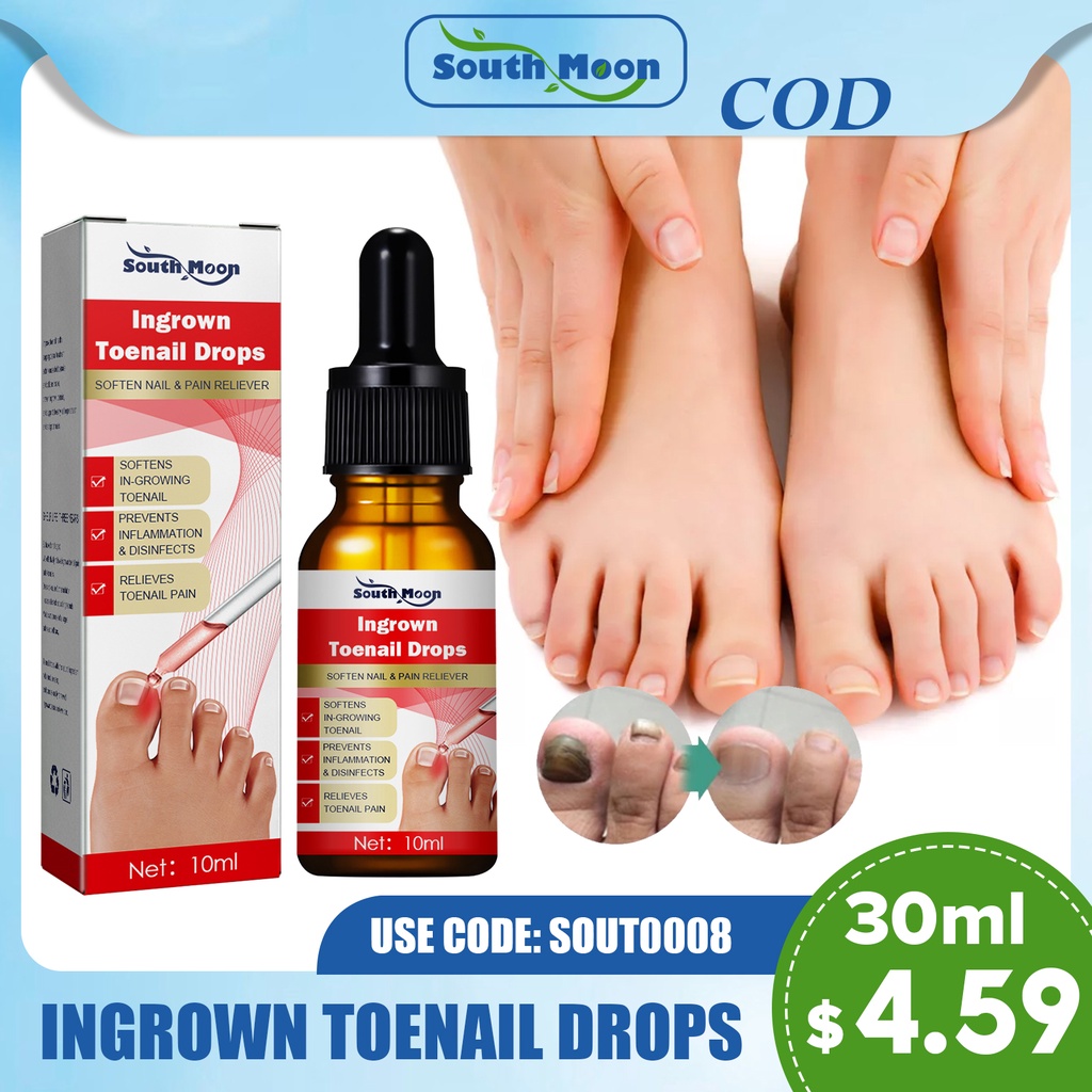 [South Moon] 30ml Ingrown Toenails Drops Gluefree Toenail Essence Oil