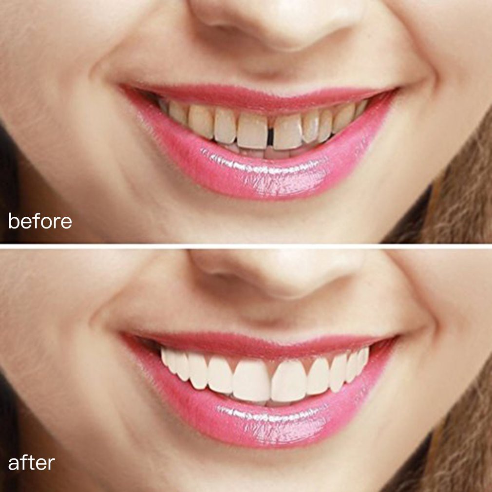 Perfect Instant Smile Comfort Fit Flex Teeth Whitening Denture Paste