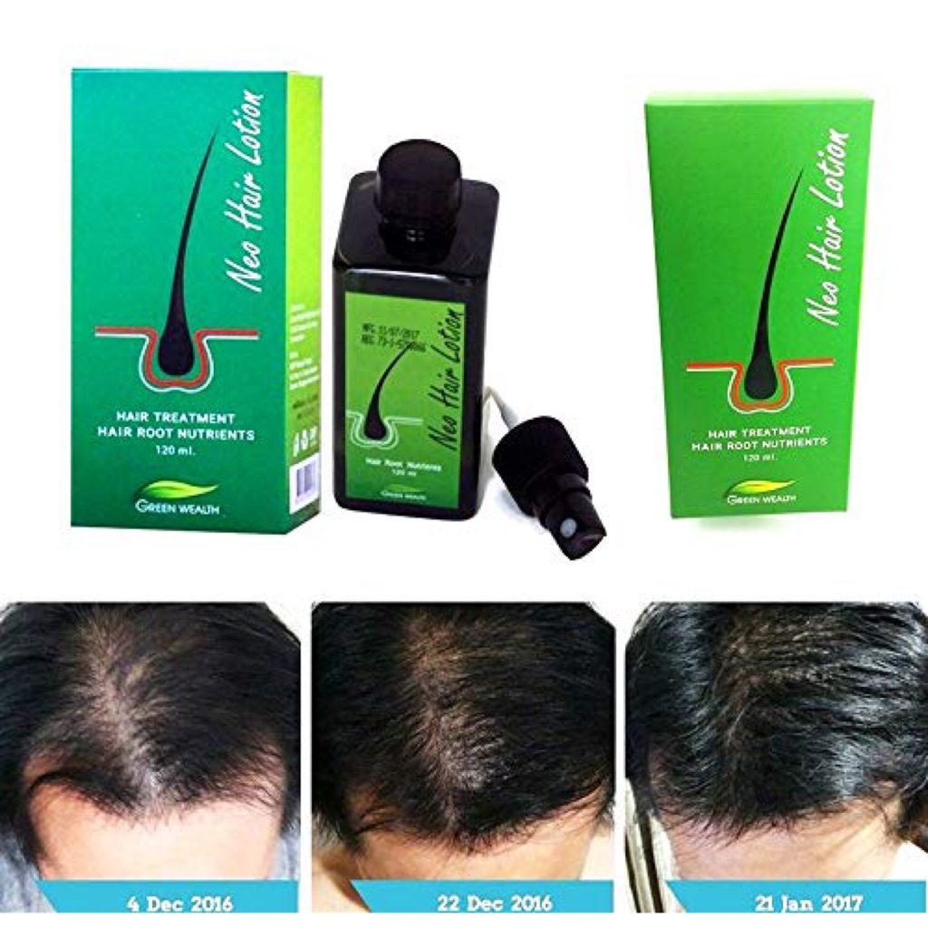 2 Box Original Neo Hair Lotion / Neo Hair Oil AntiHair Loss Hair Tonic