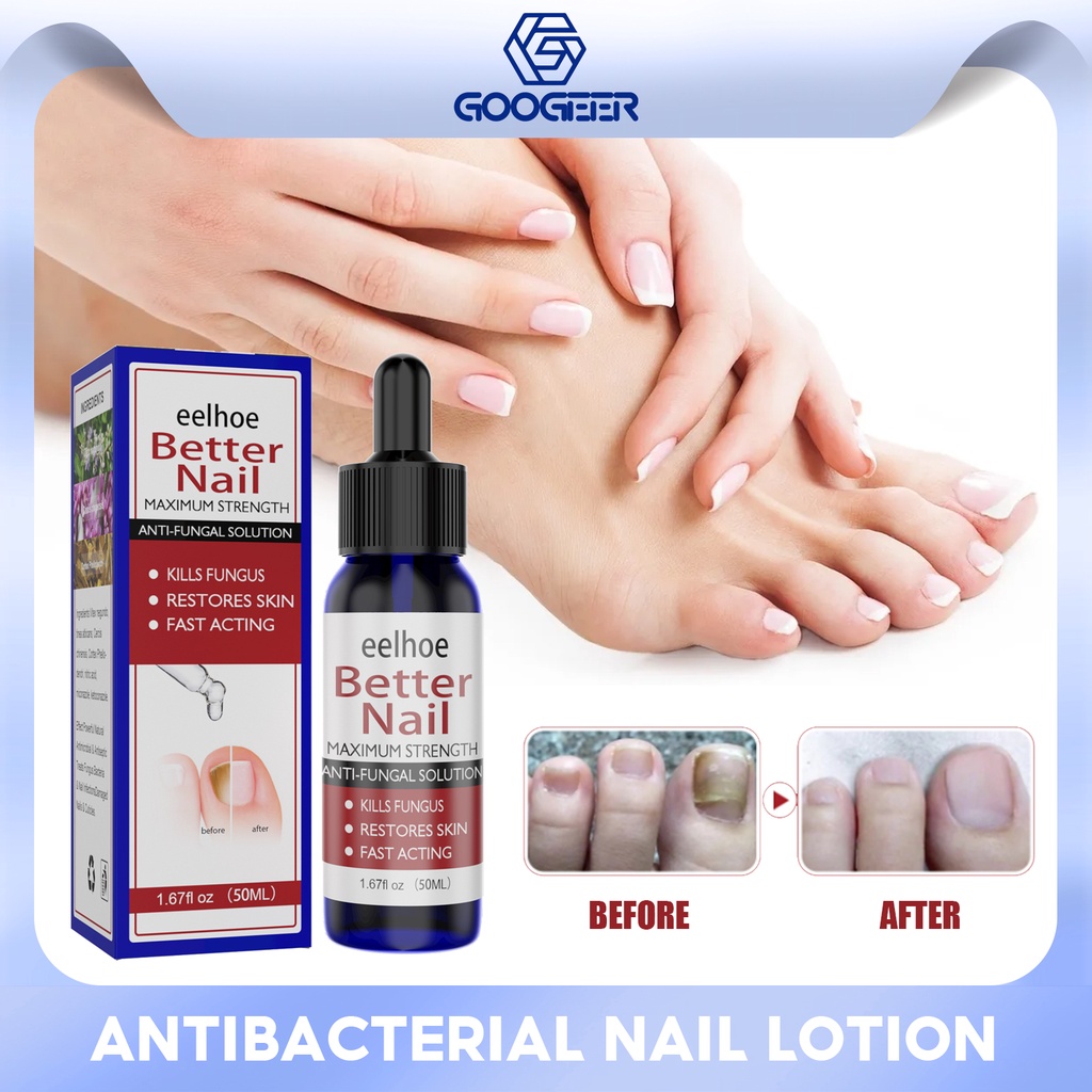Antifungal Nail Gel Fungal Nails Treatment Serum Hand Foot Cream
