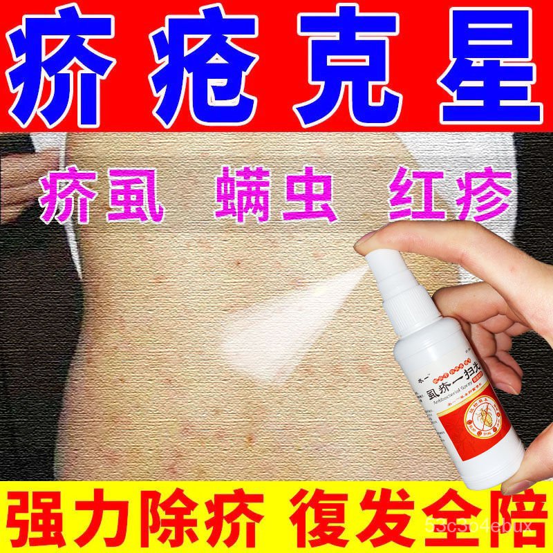 Scab Cream, AntiItching Spray, AntiItching Effect, Head Lice Crab