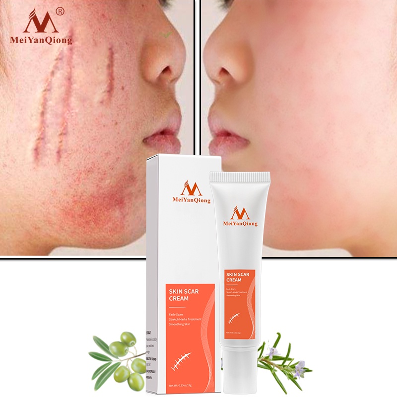 MeiYanQiong Acne Scar Removal Cream Skin Repair Stretch Marks giảm sẹo