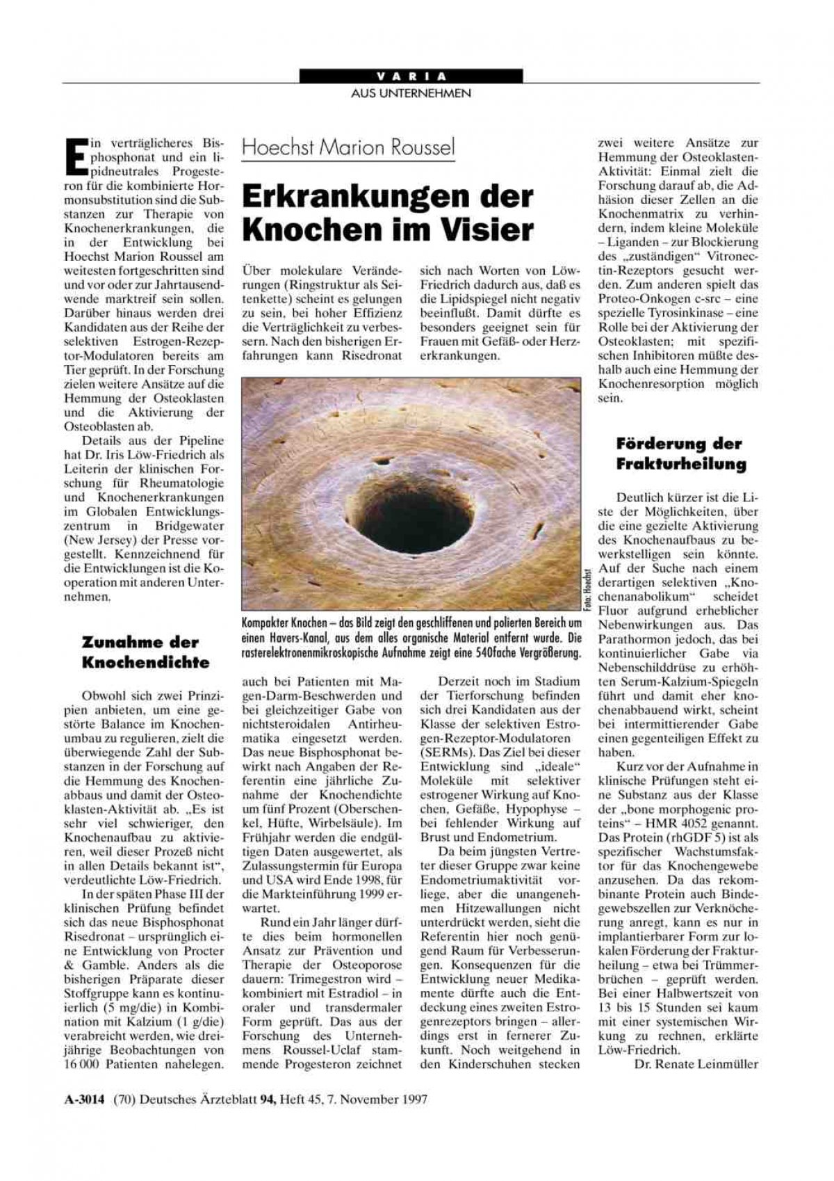 Hoechst Marion Roussel Erkrankungen der Knochen im Visier