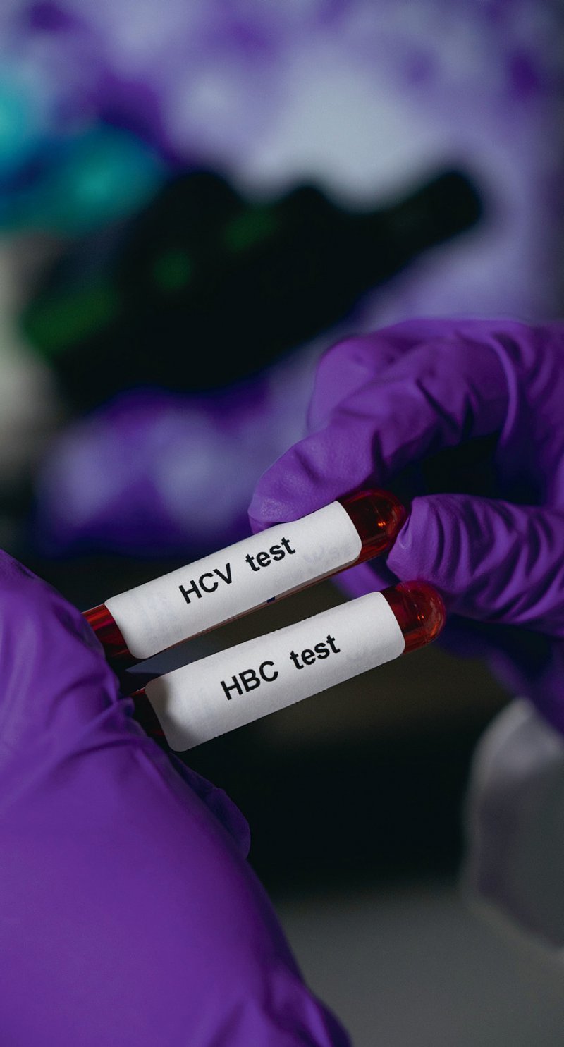 Neuer Checkup für die Leber Warum HepatitisTests so sinnvoll sind