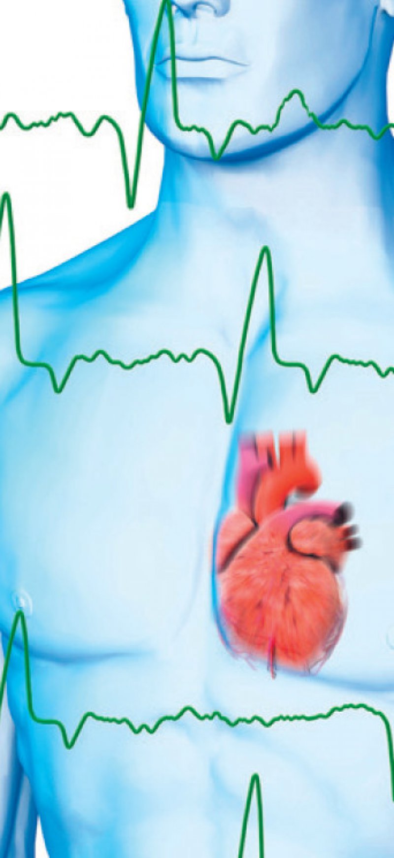 Vorhofflimmern Apixaban bei HerzNierenKranken so wirksam und sicher