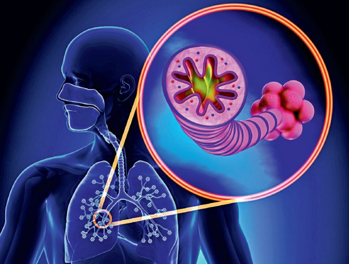 COPD Opioide und Benzodiazepine in niedriger Dosierung sicher