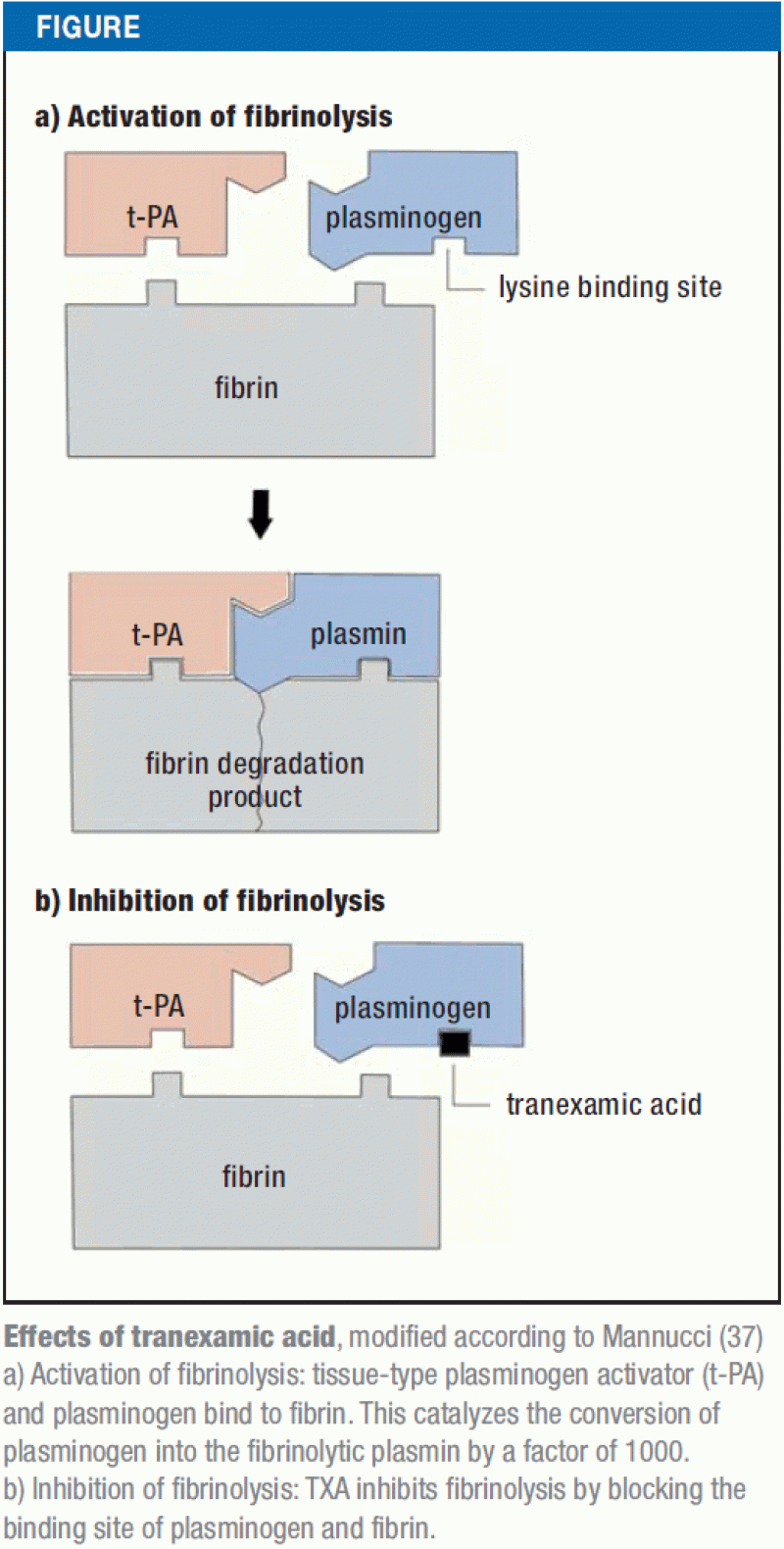 Tranexamic Acid Prophylaxis in Hip and Knee Joint Replacement (01.12.2017)