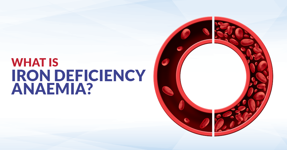 Iron Deficiency Anaemia CFCH Centre for Clinical Haematology