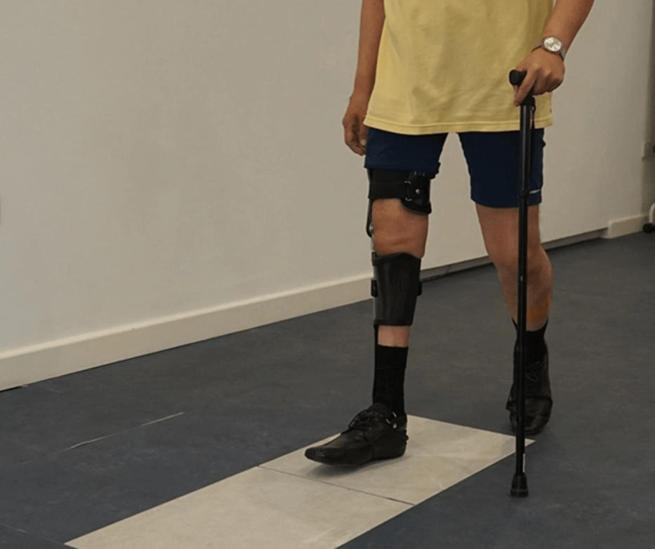 Best Stem Cell Treatment for Polio Syndrome Proven and Effective