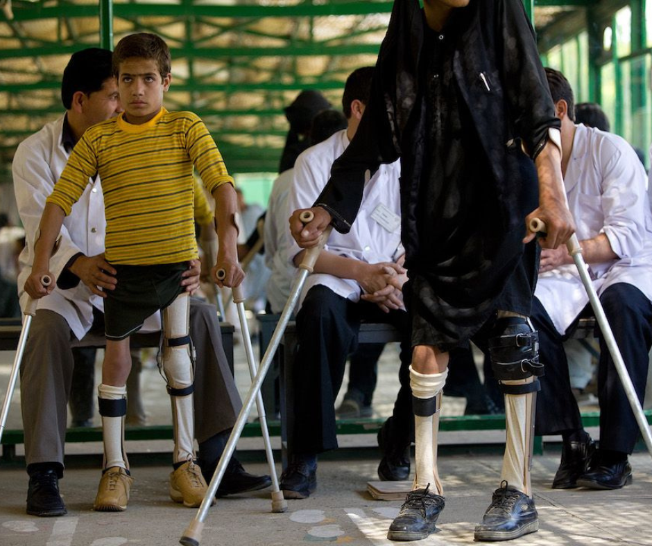 Best Stem Cell Treatment for Polio Syndrome Proven and Effective