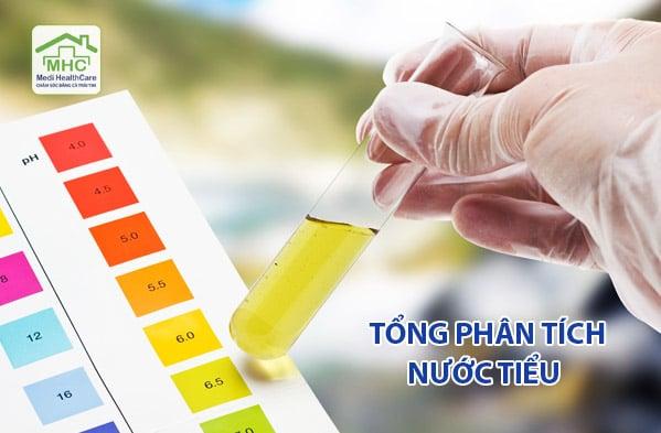 xet-nghiem-tong-phan-tich-nuoc-tieu