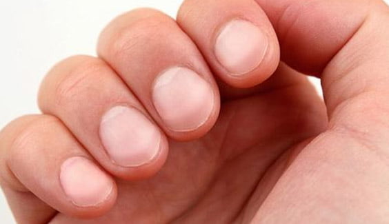 doan benh qua ban tay ngon tay dui trong  Nhìn tay đoán bệnh: Kiểm tra sức khỏe ngay nếu tay bạn có những dấu hiệu sau doan benh qua ban tay ngon tay dui trong