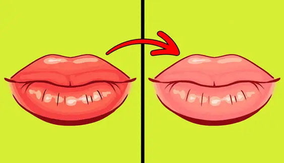 Đừng chủ quan, hãy nhớ những dấu hiệu của đôi môi cho thấy sức khỏe đang &#8216;kêu cứu&#8217; bạn doan benh qua doi moi mau sac cua doi moi