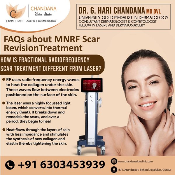 Best Dermatologist In Guntur Chandana Skin Clinic