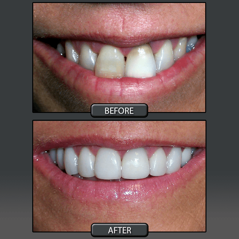 Services Provided at Center for Cosmetic Dentistry Dr. John E. Hoar