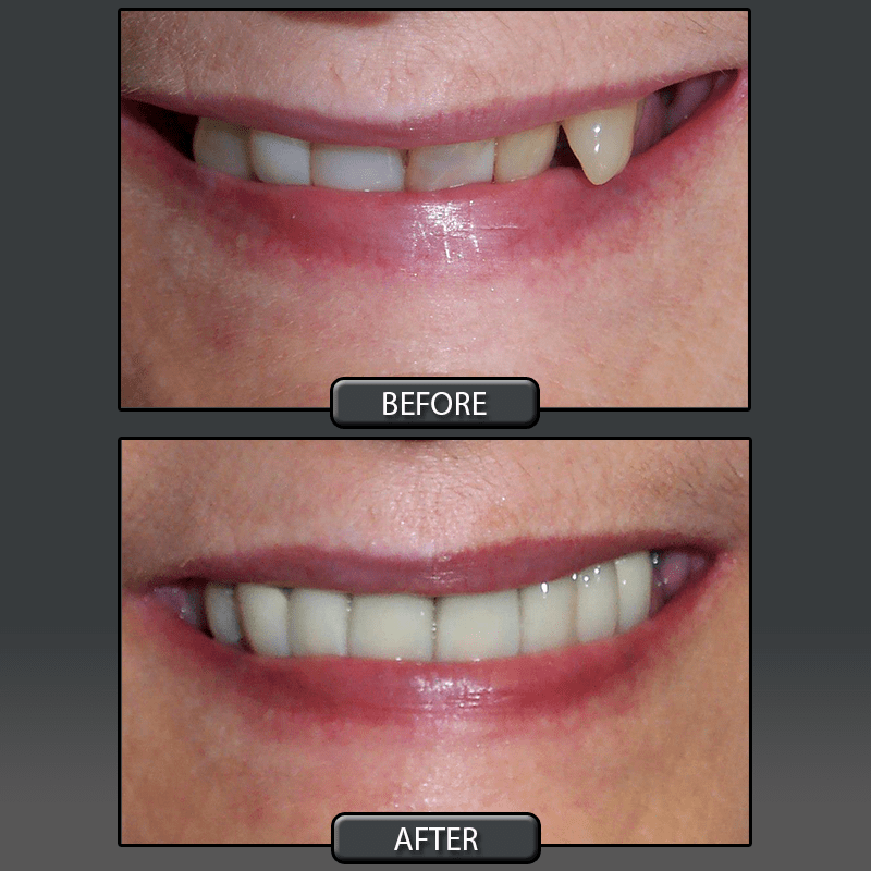 Services Provided at Center for Cosmetic Dentistry Dr. John E. Hoar