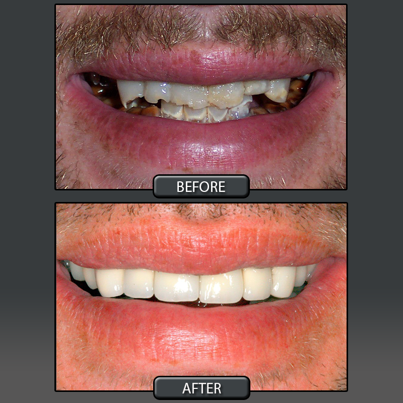 Services Provided at Center for Cosmetic Dentistry Dr. John E. Hoar