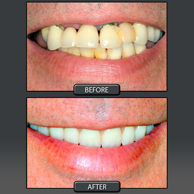 Services Provided at Center for Cosmetic Dentistry Dr. John E. Hoar