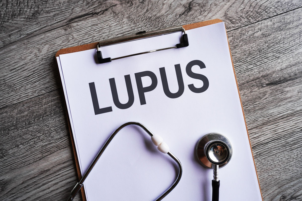 What Is Lupus? Chaparral Winds Retirement Community