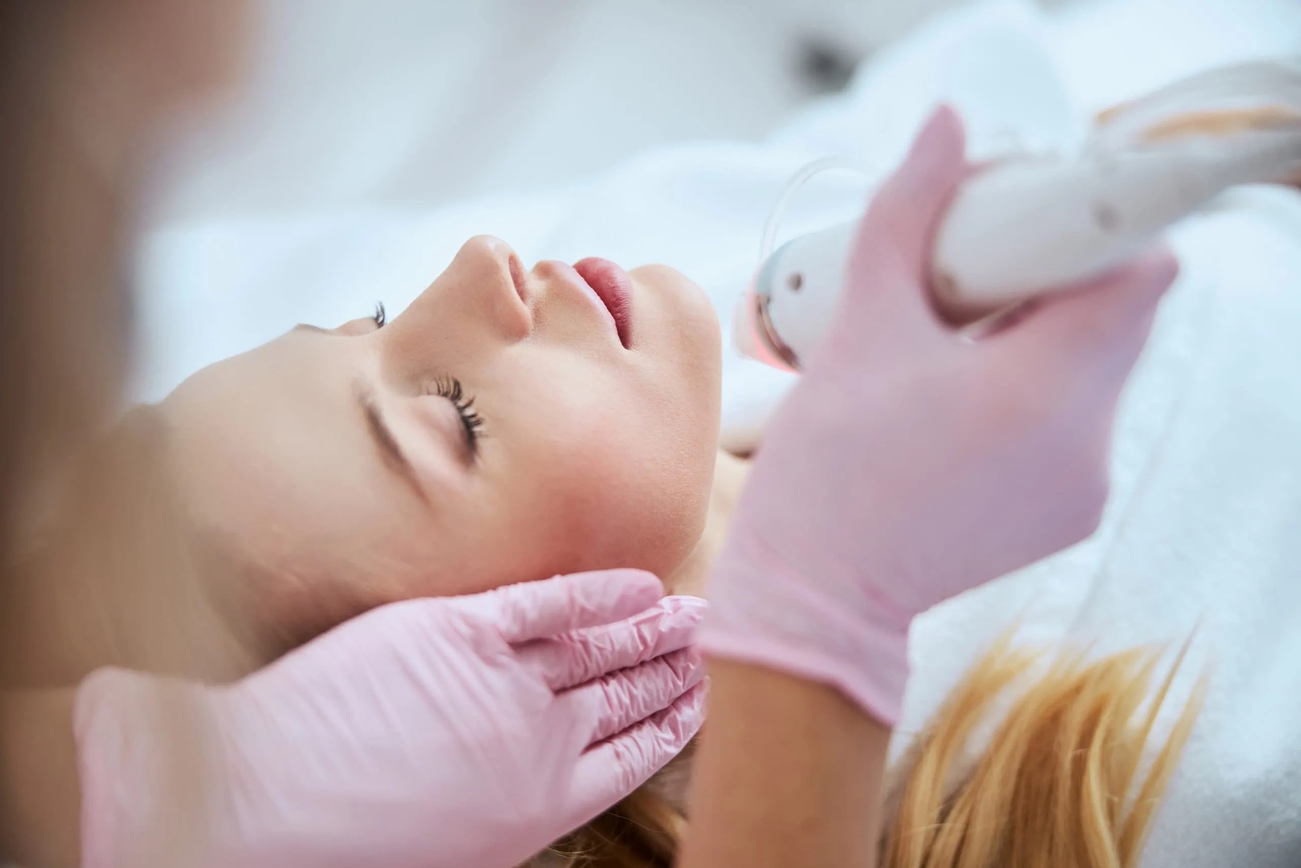 RF Microneedling For Scar Removal Charette Cosmetics