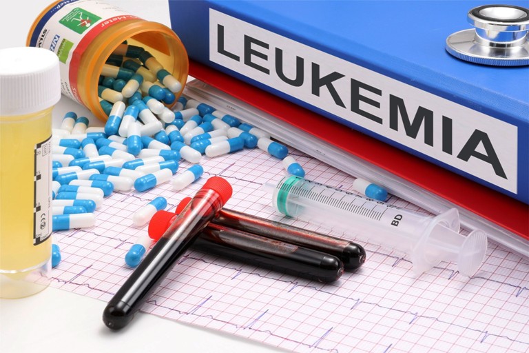 Leukemia Symptoms and Treatment