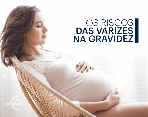 Varizes na gravidez mantenha sua saúde vascular nesse período Dr