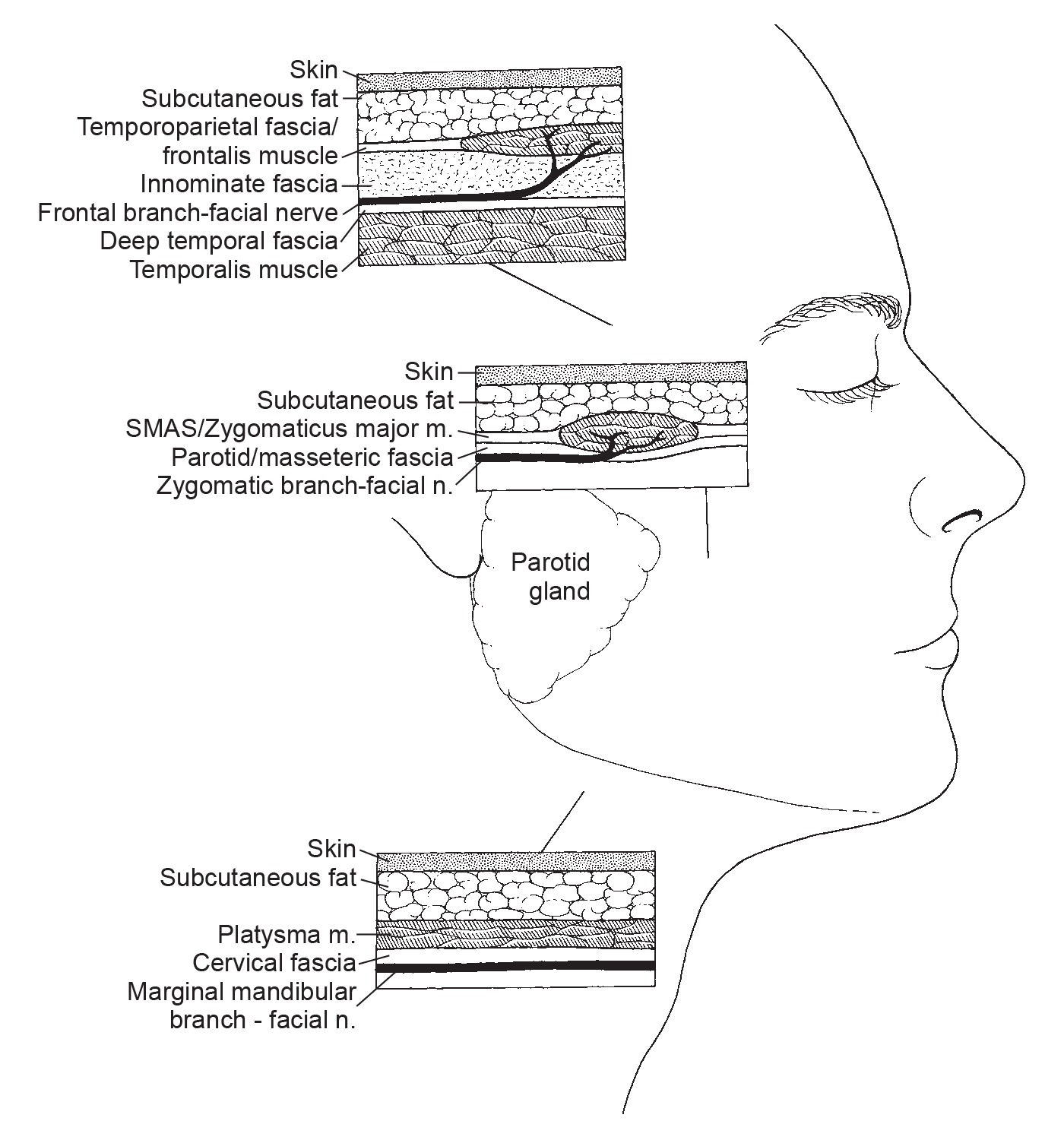 Facelift Anatomy NYC Plastic Surgeon