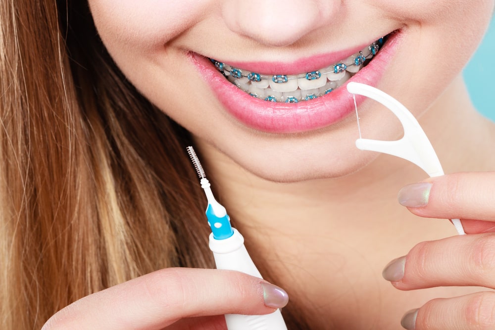 Finding the Right Dental Floss to Use with Braces Charleston