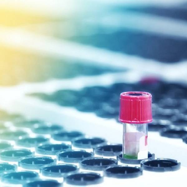 Scandal in Silicon Valley Wall Street Journal's John Carreyrou on the