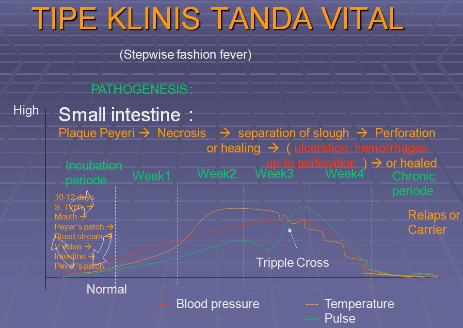 Stepwise fashion fever / Tifoid Chendoe's Blog