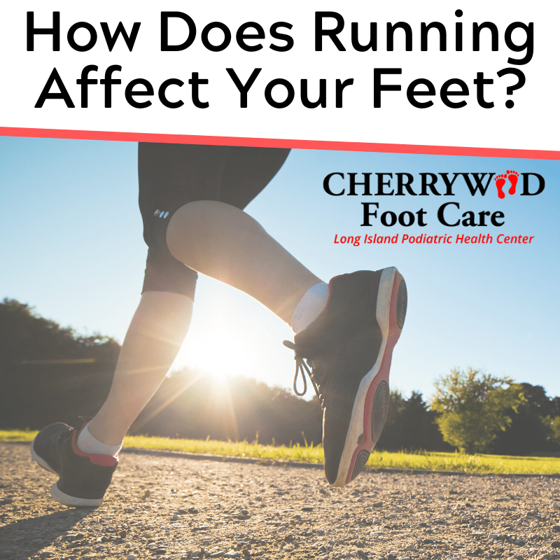 How Does Running Affect Your Feet? Cherrywood Foot Care