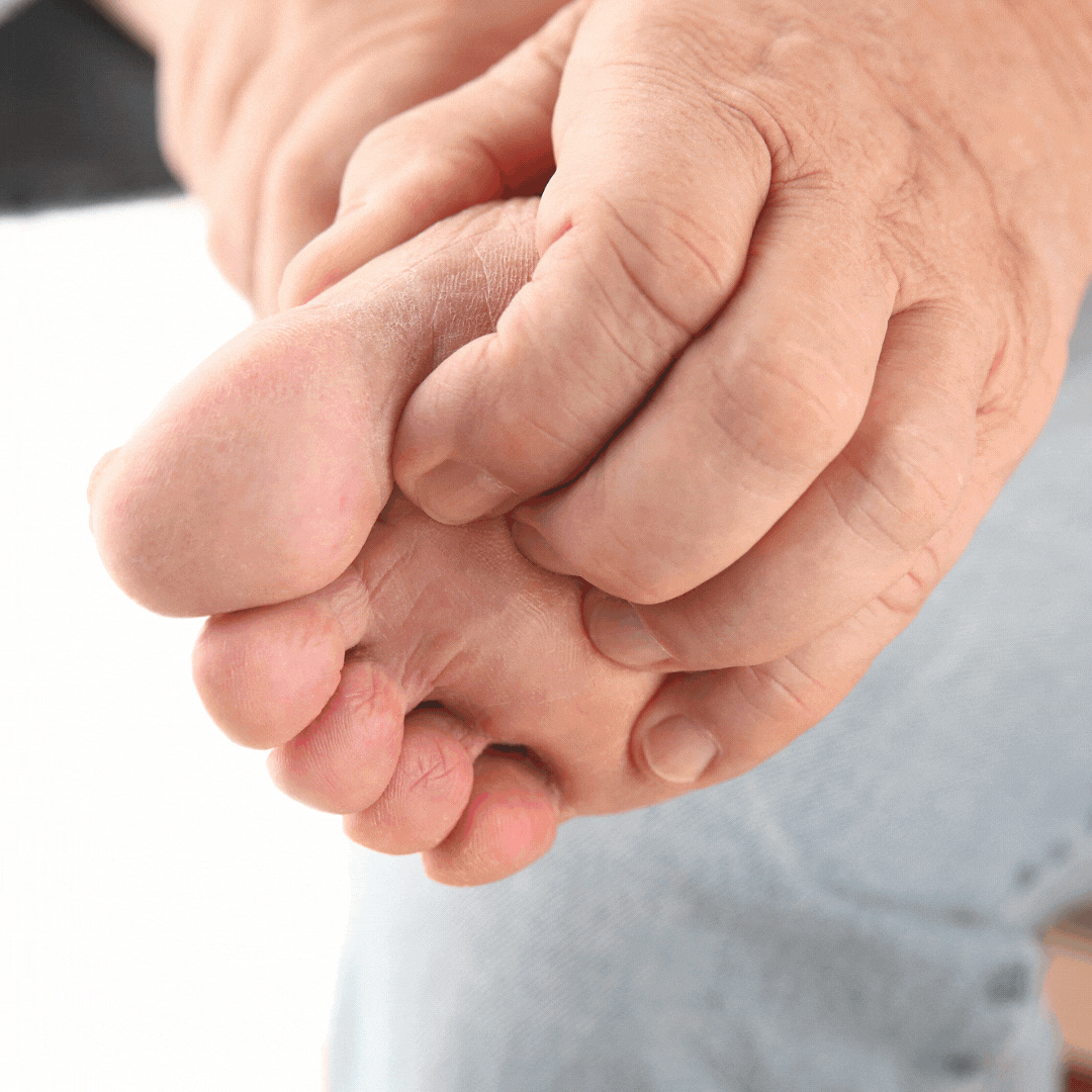 Foot Doctor Massapequa Signs Of Plantar Fibromas