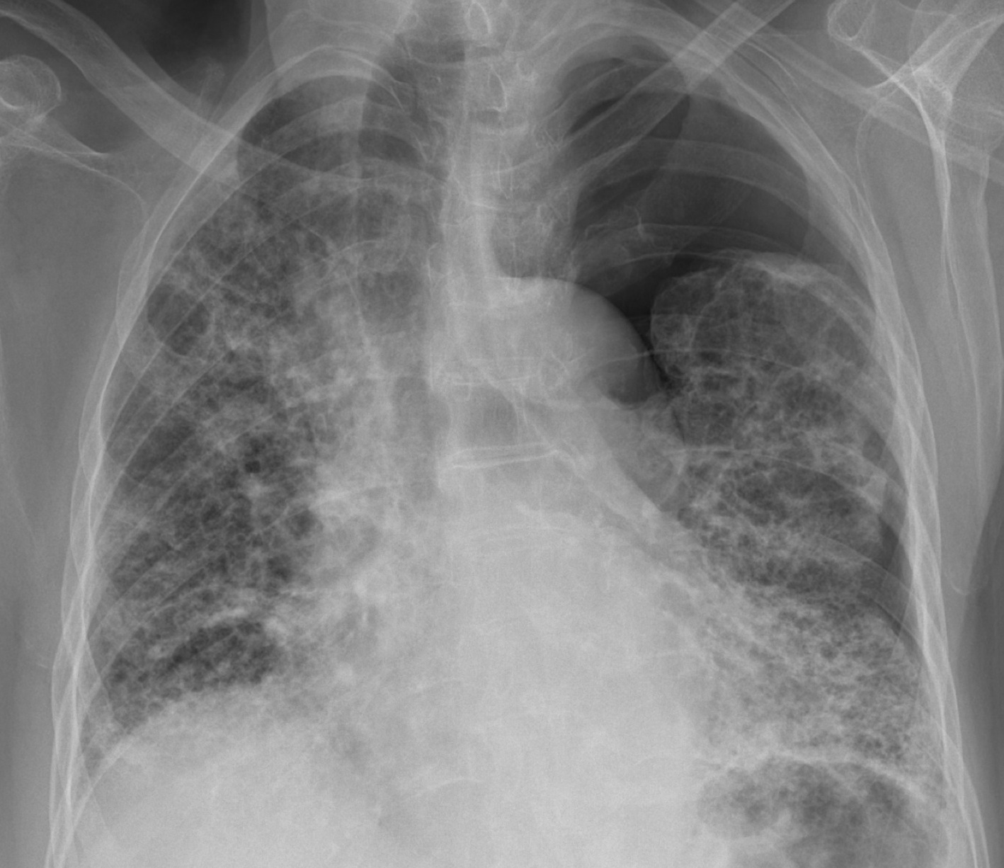 Chest Radiologists Collaborative