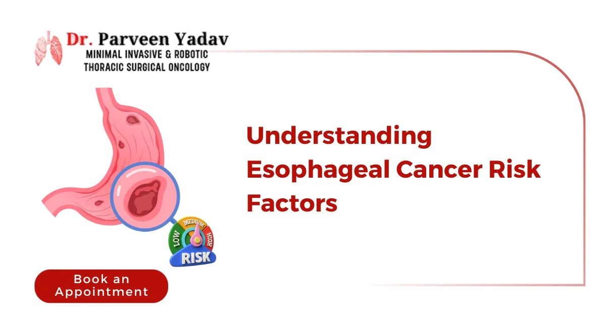Guarding Against Esophageal Cancer Unraveling Risk Factors