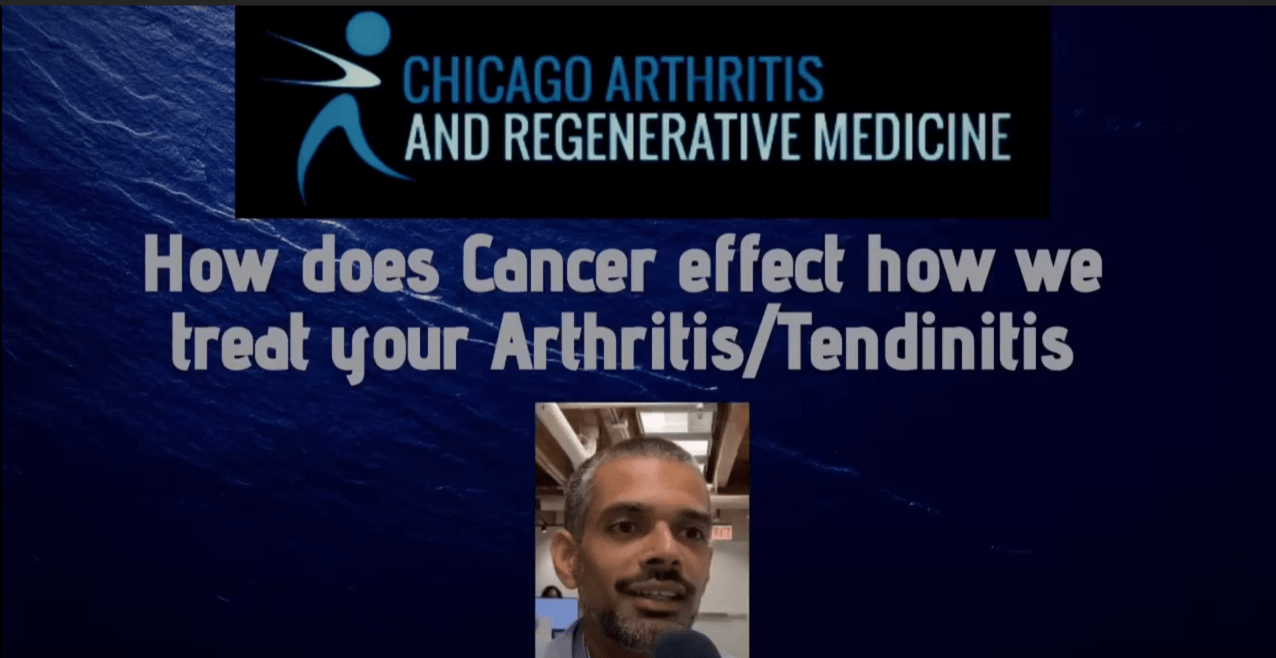 Tendinitis Archives Chicago Arthritis and Regenerative Medicine